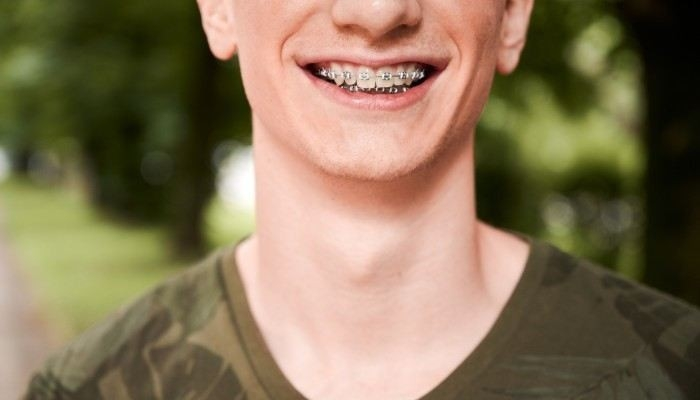 Требования к состоянию здоровья для призывников с брекетами