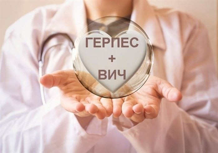 Отсрочка от армии с герпесом: как получить