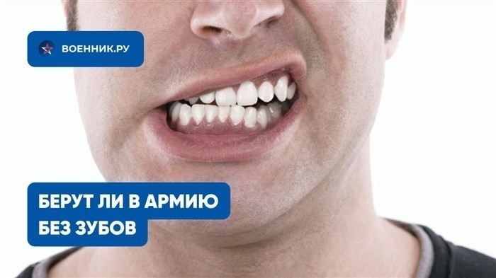 Как отсутствие зубов влияет на призыв в армию: что говорит военная комиссия