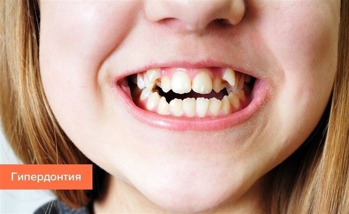 Какие признаки кариеса у детей требуют немедленного внимания?