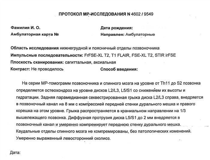 Как радикулопатия влияет на физическую подготовленность военнослужащих?